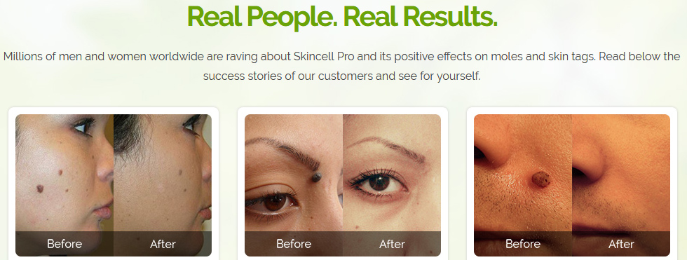 Skincell Pro Before after