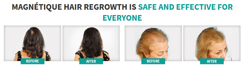 Magnetique Hair Growth before after