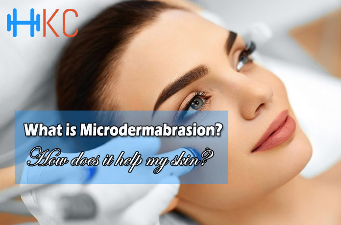 What is microdermabrasion