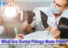 What Are Dental Fillings Made From