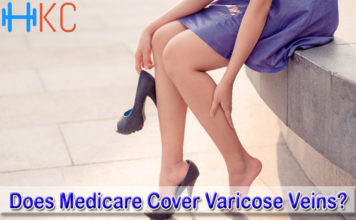 Does Medicare Cover Varicose Veins?