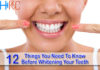 12 Things You Need To Know Before Whitening Your Teeth