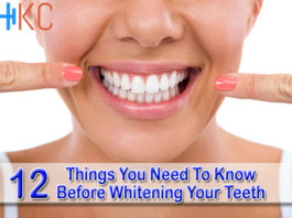12 Things You Need To Know Before Whitening Your Teeth