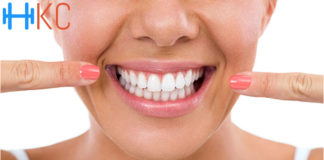 12 Things You Need To Know Before Whitening Your Teeth
