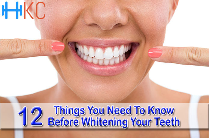 12 Things You Need To Know Before Whitening Your Teeth