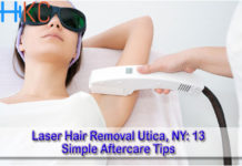 Laser Hair Removal Utica