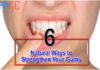 6 Natural Ways to Strengthen Your Gums