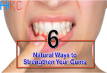 6 Natural Ways to Strengthen Your Gums