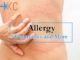 Allergy Treatments and More