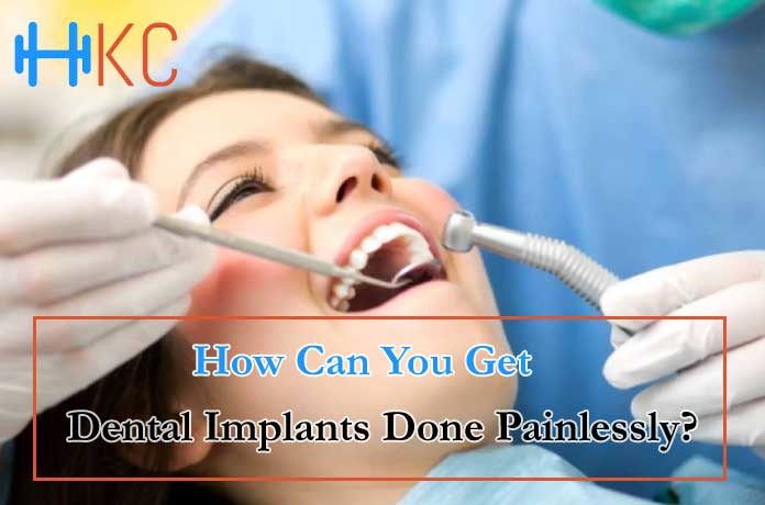 How Can You Get Dental Implants