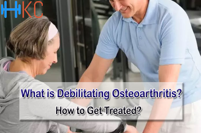 What is Debilitating Osteoarthritis
