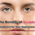 Benefits of Sculptra Treatment