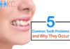 Common Teeth Problems