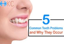 Common Teeth Problems