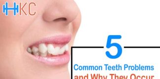 Common Teeth Problems