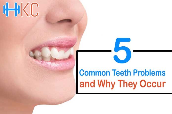 Common Teeth Problems