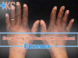 Know about Eczema