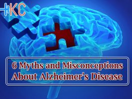 Myths and Misconceptions About Alzheimer's Disease