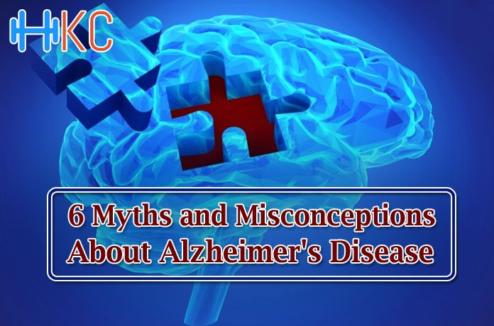 Myths and Misconceptions About Alzheimer's Disease