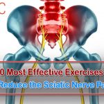 Exercises to Reduce the Sciatic Nerve Pain