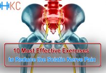 Exercises to Reduce the Sciatic Nerve Pain