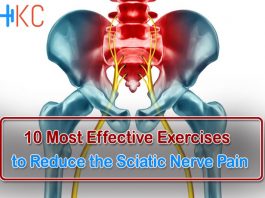 Exercises to Reduce the Sciatic Nerve Pain
