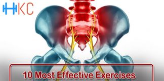 Exercises to Reduce the Sciatic Nerve Pain