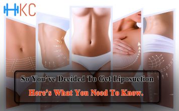 To Get Liposuction