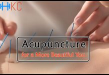 Acupuncture for a More Beautiful