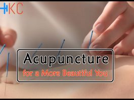 Acupuncture for a More Beautiful