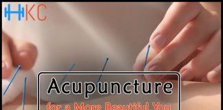 Acupuncture for a More Beautiful