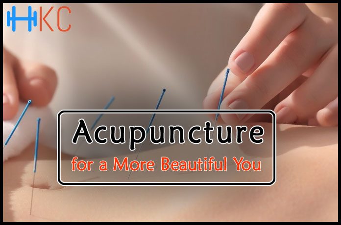 Acupuncture for a More Beautiful