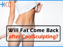 CoolSculpting