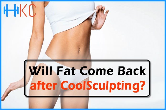 CoolSculpting