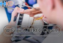 What Is A CEREC Crown?