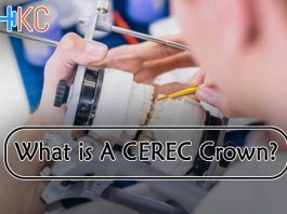 What Is A CEREC Crown?