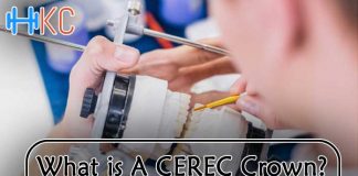 What Is A CEREC Crown?