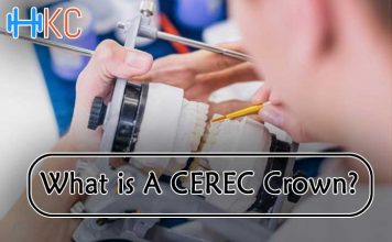 What Is A CEREC Crown?