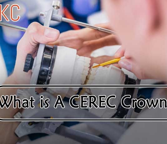 What Is A CEREC Crown?