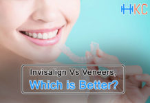 Invisalign Vs Veneers