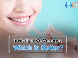 Invisalign Vs Veneers