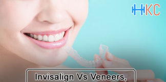 Invisalign Vs Veneers