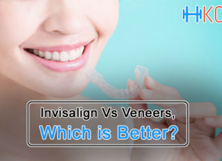 Invisalign Vs Veneers, which is better? Invisalign Vs Veneers