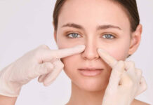 Understanding Rhinoplasty